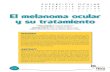 El melanoma ocular y su tratamiento - Laboratorios …...El melanoma ocular y su tratamiento Nº:30 RESUMEN Los melanomas son neoplasias malignas que derivan de los melanocitos den
