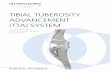 TIBIAL TUBEROSITY ADVANCEMENT (TTA) SYSTEMsynthes.vo.llnwd.net/o16/LLNWMB8/US Mobile/Synthes North America... · 10 DePuy Synthes Vet Tibial Tuberosity Advancement (TTA) System Surgical
