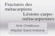 Fractures des m tacarpiens L sions carpo- m tacarpiennes · 2011-07-04 · Fractures du col du m tacarpien •Fractures articulaires:-Rare. - Décollements épiphysaires, avulsions