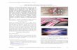 MECHANICS BIOMATERIALS:STENTS of stents.pdf · May 2004 Applications of Engineering Mechanics in Medicine, GED – University of Puerto Rico, Mayaguez F1 MECHANICS BIOMATERIALS:STENTS