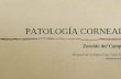 patología cornealR1.ppt [Modo de compatibilidad]€¦ · epitelio +/epitelio +/- íntegro La perineuritis es pa Infiltrados confluyen alt. epitelial Aparece edema corn ... Tipos: