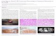 Case Report: Renal Cell Carcinoma Presenting as Cutaneous … · 2018-04-01 · In non-RCC urogenital malignancies, cutaneous metastasis occurs most frequently on the abdomen, while