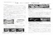 肝臓・胆のう(胆管)・膵臓検査編saiseikai.hita.oita.jp/contents/wp-content/uploads/2011/...MRCP 画像： 印は膵臓がんです。がんで膵 管が圧排され拡張しています。