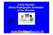 X-Ray Rounds: (Plain) Radiographic Evaluation of the Shoulder · Musculoskeletal Imaging in Shoulder Trauma – Developed in 1995, revised in 2005 – AP with IR & ER, and lateral