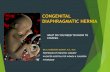 CONGENITAL DIAPHRAGMATIC HERNIA - Neocon2019 · CONGENITAL DIAPHRAGMATIC HERNIA 1 in 3000 live births. Lung hypoplasia and pulmonary hypertension. 10% risk of intrauterine fetal demise