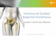 Ultrasound Guided Regional Anesthesiaanestezjologiaregionalna.pl/wp-content/uploads/2016/07/...Ultrasound Guided Regional Anesthesia Lower Extremity Blocks Lower Extremity Nerve Blocks