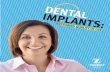 dental - Frank Ruffino DDS · 2019-08-05 · Dental implants are a safe, esthetic alternative to traditional crowns, bridgework, and dentures. Because implant restorations look and