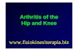 Arthritis of the Hip and Knee - Fisiokinesiterapia · Analgesics • Little evidence showing NSAID’s better than acetaminophen • Newer non-narcotic analgesics – Tramadol: Side-effect