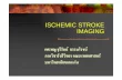 ISCHEMIC STROKE IMAGING › backup-nna › pdf_file › academic7 › 12-sy… · ISCHEMIC STROKE IMAGING ... Hemorrhagic stroke Hypertensive Non hypertensive Rupture vascular structure