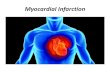 Myocardial Infarction 2019 - Medtelligence• Evidence for acute myocardial injury-cTn + • Symptoms of myocardial ischemia • New Ischemic EKG changes • Development of pathological