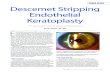 COVER STORY Descemet Stripping Endothelial Keratoplasty · PDF file Descemet stripping endothelial keratoplasty (DSEK) is the most widely adopted EK technique domesti-cally and throughout