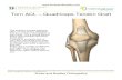 Torn ACL – Quadriceps Tendon Graft - Burke and Bradley...new ACL Graft. The end of the graft is tied to a loop on the guide wire and the graft is pulled into place. Securing the