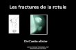 Les fractures de la rotule - orthopedie-lyon.frorthopedie-lyon.fr/.../2012/02/DIU-GENOU...CANTIN.pdf · Les fractures de la rotule •1% des fractures du squelette •Toute fracture