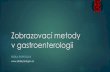 Zobrazovací metody v gastroenterologii · Krvácení do GIT endoskopicky UZ pasáž GIT scintigrafie angiografie CT - třífázové vyšetření (arteriální, enterální, odložená)