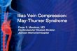 Iliac Vein Compression: May-Thurner Syndrome...May-Thurner is likely more common than we thought • Patients with severe chronic venous disease (37% >50% stenosis)1 • There are