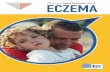 What you about ECZEMA - Irish Skin Foundation · Atopic eczema (or atopic dermatitis) is the most common form of eczema, and is the main focus of this booklet. Other types include
