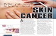What you need to know about skin cancerSkin cancer is the abnormal growth of genetically damaged skin cells. Virtually all skin cancer is linked to sun exposure. The cellular damage