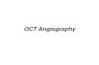 OCT Angiography: The Newest Frontier for the Revolutionary ... › sites › default › ... · Influenza della lunghezza d’onda: Spectralis vs Swept Source OCT . Artefatti di proiezione