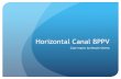 Horizontal Canal BPPV - dptportfolios.web.unc.edudptportfolios.web.unc.edu › files › 2017 › 04 › Owens_K_Case_Report.… · Horizontal Canal BPPV Case report by Kenzie Owens