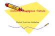 Carotid cavernous fistula - Semantic Scholar...Carotid-cavernous fistulae : Part 1: presentation and features IN: Neurovascular surgery surgery. McGraw-Hill,INC.,1995:1056-7 Fabian