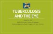 Tuberculosis and the eye - Pacific University...Who’is’at’high’riskfor’TB? Individuals at higher risk for TB: • Close contacts of patients suspected of having TB • Immune