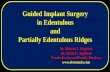 Guided Implant Surgery in Edentulous and Partially Edentulous …€¦ · Guided Implant Surgery in Edentulous and Partially Edentulous Ridges Dr. Michael J. Maginnis Dr. Glenn E.