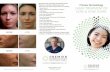 PD Laser Treatment Acne MECH - Premier Dermatology€¦ · LASER TREATMENT OF ACNE & ACNE SCARS With advanced technology and skilled hands, ... The physicians of Premier Dermatology