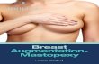 Breast Augmentation- Mastopexy · These implants are breast shaped, so are fuller at the bottom and emptier at the top of the implant when under the breast. Anatomical implants used