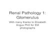 Renal Pathology 1: Glomerulus · Renal Pathology 1: Glomerulus With many thanks to Elizabeth Angus PhD for EM photographs