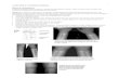 5repo.knmu.edu.ua/bitstream/123456789/2853/6/Skelet … · Web viewAnkylosing spondylitis Psoariasis Juvenile chronic arthritis Radiographic features: Asymmetrical distribution, usually