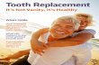 Tooth Replacement · patients enjoy greater self-confidence, a higher quality of life and better nutrition when implant-retained overdentures are used to replace conventional dentures.