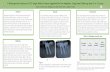 A Retrospective Analysis of 125 Single Molar …...implants for single molar replacement: clinical evaluation of prospective and retrospective materials. Clin Implant Dent Relat Res