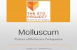 Molluscum€¦ · THE STD PROJECT Breaking the Stigma . Title: Chancroid Author: Do Not Use Created Date: 8/14/2017 12:37:02 PM