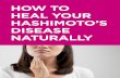 HOW TO HEAL YOUR HASHIMOTO’S DISEASE NATURALLY€¦ · fight fatigue and help to heal a leaky gut All of these benefits have a direct impact on boosting your immune system, and
