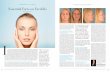 WESTLAKE MALIBU LIFESTYLE 05.16 Essential Facts on Facelifts · Facelifts can set the clock back typically as much as ten years or more. Having a facelift at a younger age provides