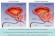Patologia sistemului genital masculin, infecţiile sexual … · 2019-11-16 · Patologia sistemului genital masculin, infecţiile sexual transmisibile. Болезни мужских