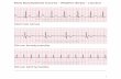 ECG Dysrhythmia Course - Rhythm Strips · ECG Dysrhythmia Course - Rhythm Strips - Labelled Normal sinus _____ Sinus bradycardia _____ Sinus tachycardia