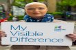 CHANGING FACES: (MYVISIBLEDIFFERENCE · Having a visible difference can also impact body confidence and self-esteem. Almost a quarter of people (23%) with a visible difference say