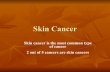 Skin cancer is the most common type of cancer 2 out of 5 ...dsapresents.org/staff/john-jackson/wp-content/.../11/skin-cancer-bur… · Skin Cancer Types Slide 4.30 • Basal cell