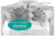 Interventional pulmonology 2019-06-13آ  6 CRYOADHESION Cryoadhesion is used in interventional pulmonology,