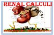 Renal calculi•Nephrolithiasis refers to renal stone disease; urolithiasis refers to the presence of stones in the urinary system. Stones, or calculi, are formed in the urinary tract