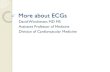 More about ECGs - College of Medicine · More about ECGs David Wni chester ,MD MS Assistant Professor of Medicine . Division of Cardiovascular Medicine