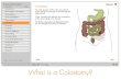 What is a Colostomy? - Liberty Medicalnurse.libertymed.com.au/resources/E-Stoma Guide - A4.pdf · Colostomy skin care The area around a stoma, where the stoma appliance is attached,