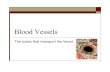 Blood Vessels - Westmont College · Transports blood away from heart to body Systemic arteries carry blood high in 02 Pulmonary arteries carry blood low in 02 Vein Wider than artery