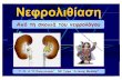 Νεφρολιθίαση - evaggelismos-hosp.grΝεφρολιθίαση Από τη σκοπιά του νεφρολόγου Γ.Ν.Α ““Ο Ευαγγελισμός””, , ΝΦ