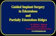 Guided Implant Surgery in Edentulous and Partially Edentulous …c2-preview.prosites.com/175607/wy/docs/GuidedImplant... · 2017. 4. 5. · Duplicate of lower partial denture is surgical