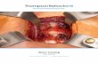 Spine Catalog - thompsonsurgical.com€¦ · SPINE CATALOG. QUESTIONS OR ADDITIONAL INFORMATION: 1.800.22.543. Thompson Retractor Exclusive Features . Uncompromised Spine Exposure.