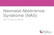 Neonatal Abstinence Syndrome (NAS) · Neonatal Abstinence Syndrome • The clinical findings associated with neonatal opioid withdrawal have been termed the neonatal abstinence syndrome