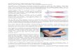 Tennis Elbow TE Golfer's Elbow GE TE lateral Golfer's ... PAIN.1.pdf · Tennis Elbow (TE) is medically known as lateral epicondylitis and causes the outer part of the elbow to become