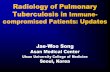 Radiology of Pulmonary Tuberculosis in Immune-compromised ... · M. tuberculosis infection Live bacilli? 900/0 LTBI -100/0 Only about 1% of the patients progress to active tuberculosis